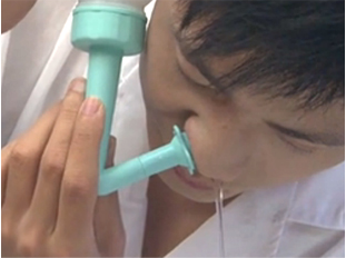 教你如何用盐水治疗鼻炎，安全有效无任何副作用