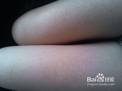 菊花茶能治鸡皮肤(雏菊花对皮肤的功效) 菊花茶能治鸡皮肤(雏菊花对皮肤的功效)