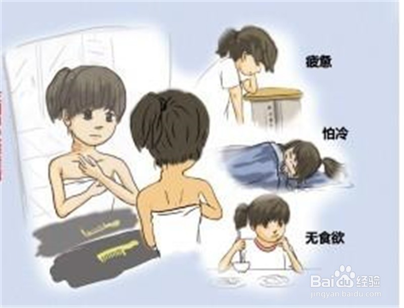 “甲低”有哪些症状?