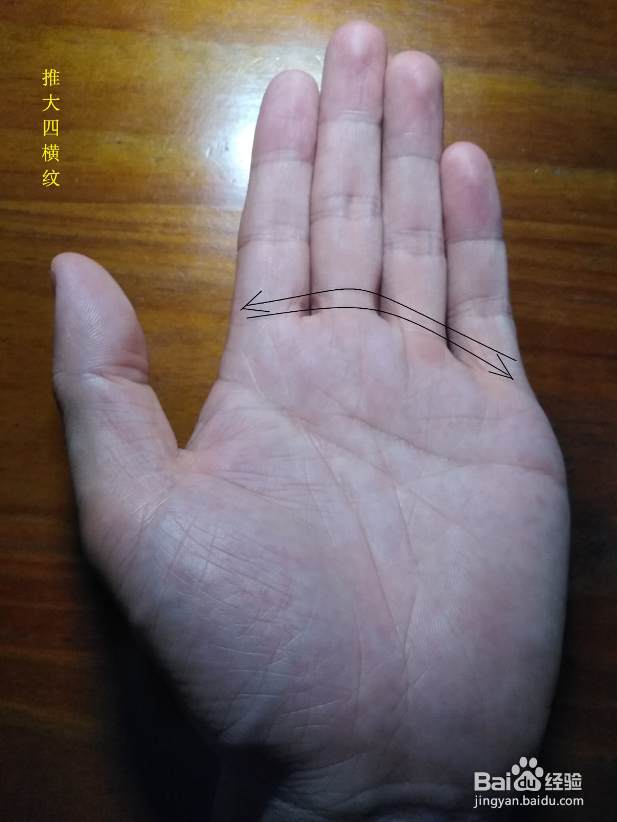 支气管炎怎么办