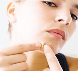 夏天应该怎样清除痘痘