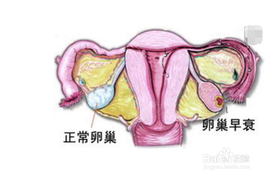 月经推迟就是怀孕了？6大原因导致必须警惕