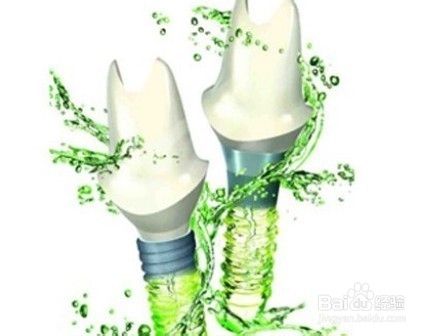 牙周炎可以做种植牙吗