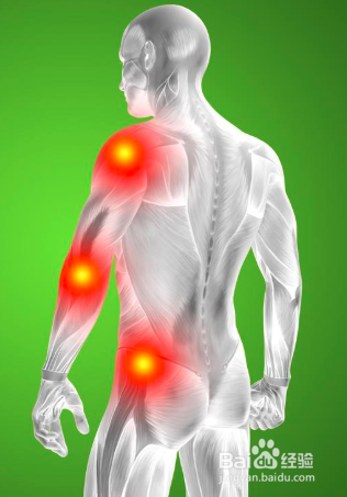 腰肌劳损怎么办？腰肌劳损治疗方法中医更有优势