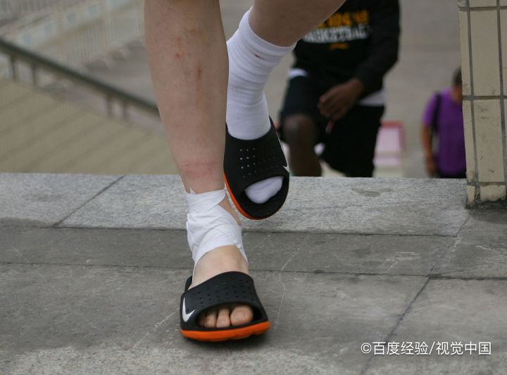 包扎方法有哪几种