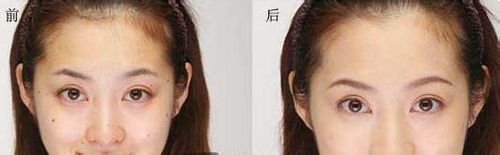 完美遮瑕的方法