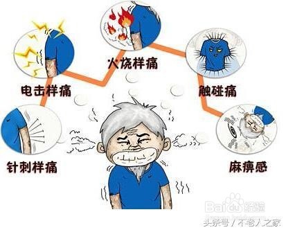 带状疱疹疫苗有必要接种吗?