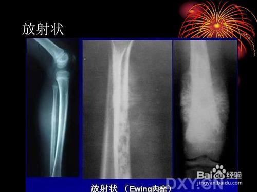 X射线是怎么成像的