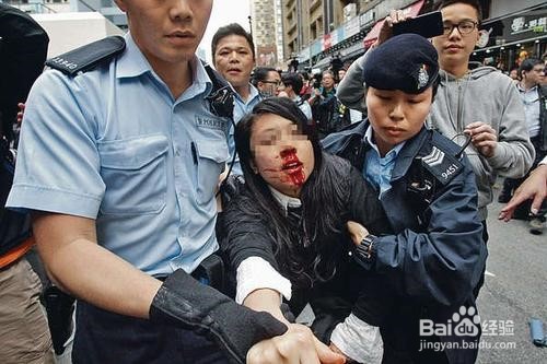 受伤时候如何快速止血