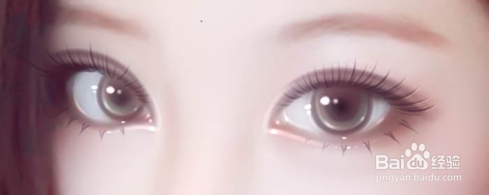 眼睛红肿疼痛怎么办