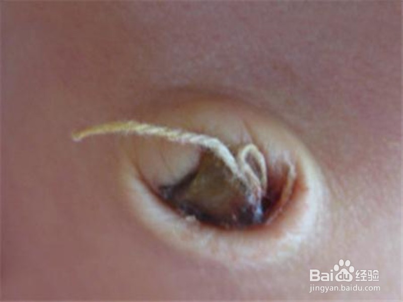 如何护理好宝宝的脐带