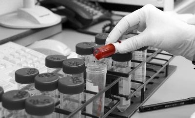 高血压患者哪些项目是必须检查