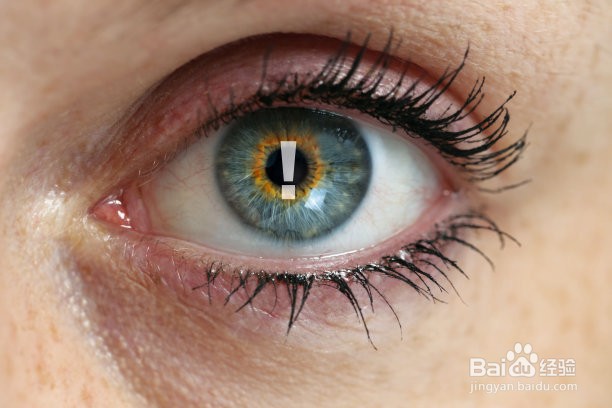 如何改善眼睛疲劳所带来的飞蚊症?