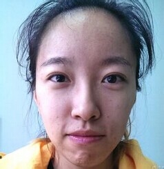 吃什么会长痘痘？