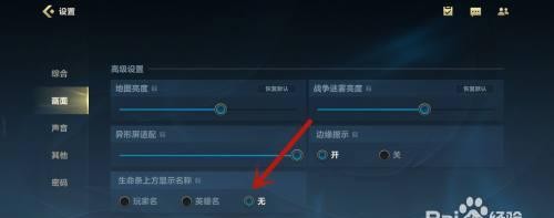 英雄联盟手游为何不显示玩家名字？