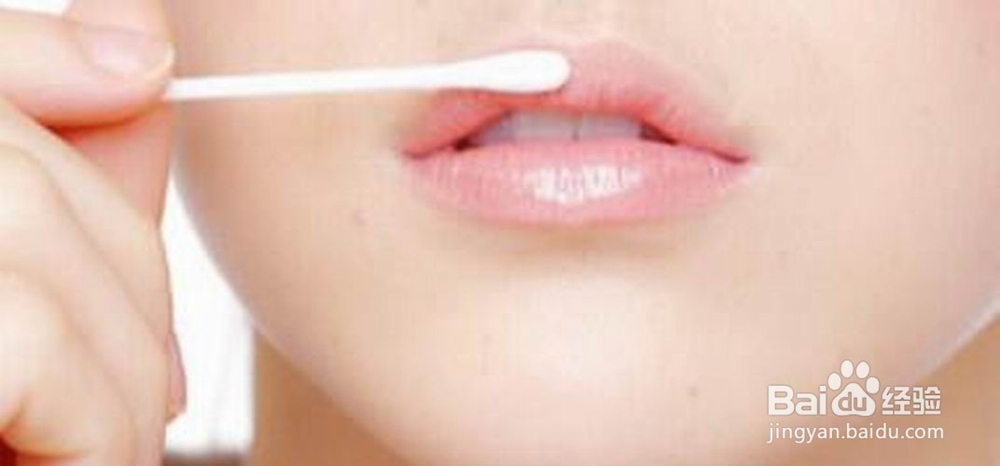 嘴唇总裂要怎么办？