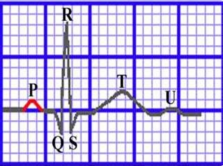 心电图各种波段解析