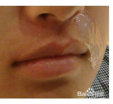 唇毛怎么去除?唇毛可以永久去除吗?