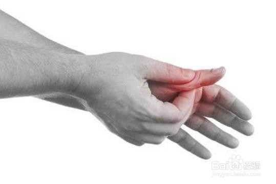 怎样预防痛风的急性发作