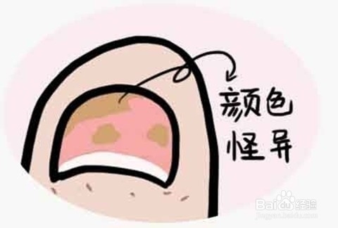 怎么看指甲异常判断宝宝健康状况，以及解决办法