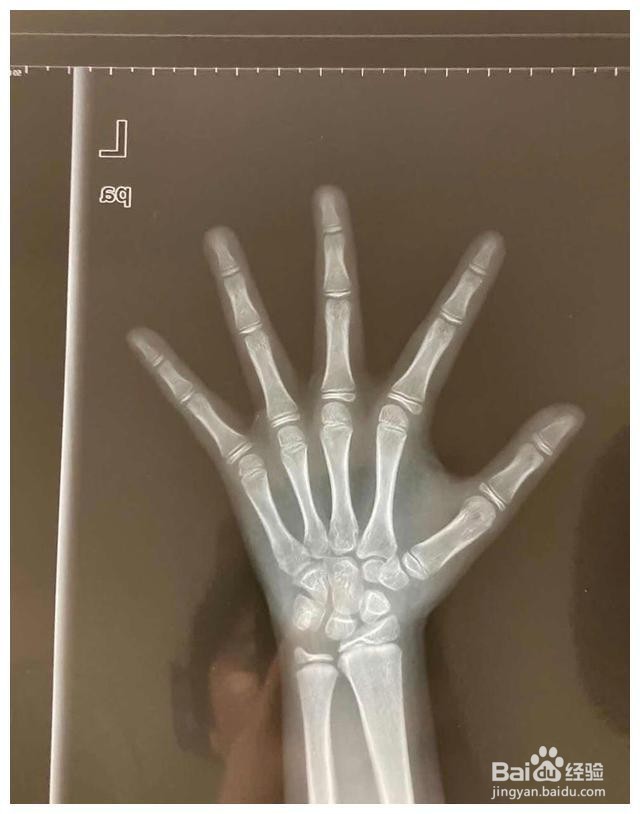 如何判断人的年龄最科学
