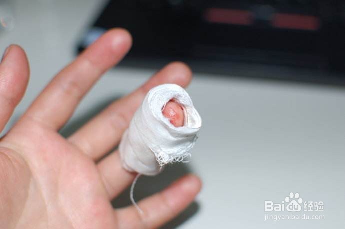 手部怎么防止感染。