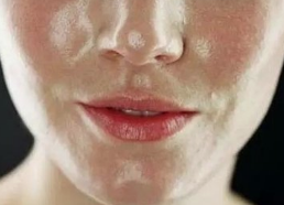 油性皮肤是否需要用护肤品？