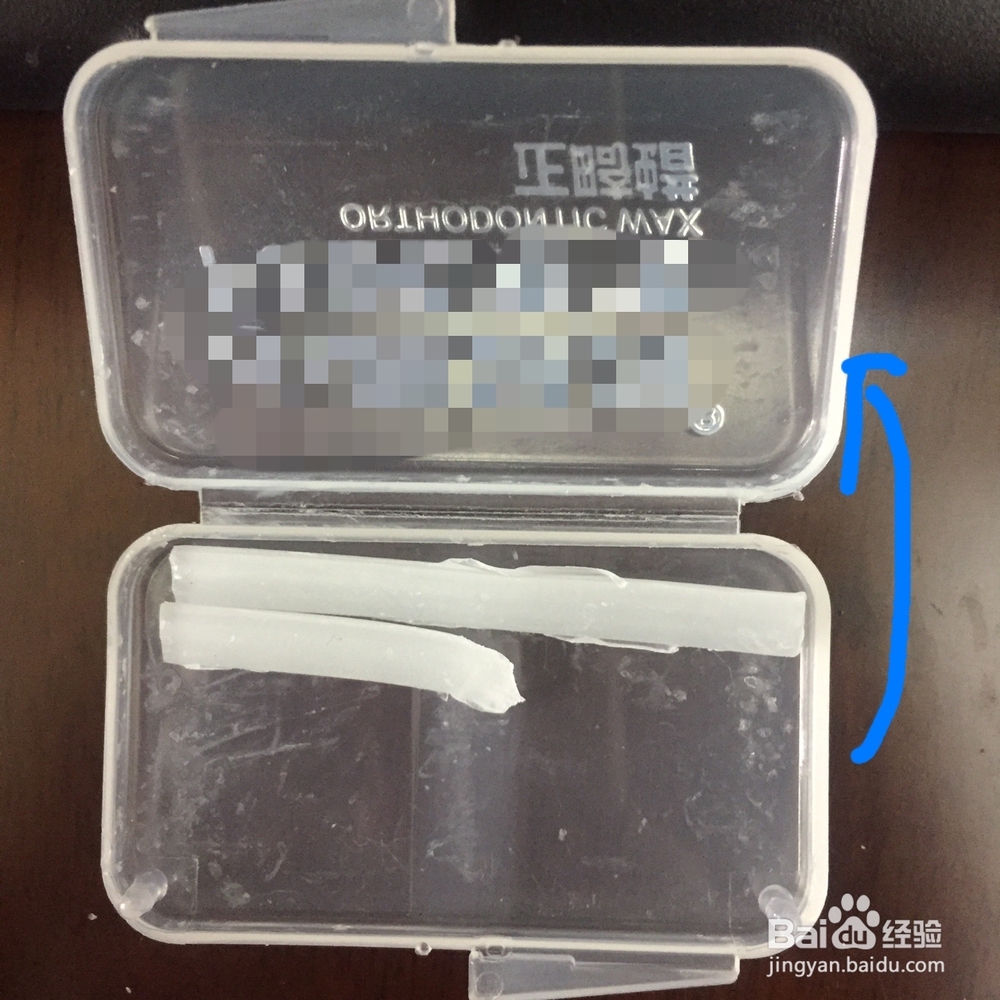 正畸蜡如何使用与保存