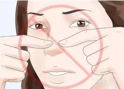 怎样控制皮肤长黑头