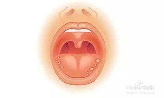 <b>口腔溃疡引起的原因有哪些</b>