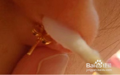 塑料耳塞硬化了怎么拿