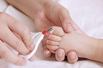 甲沟炎、脚趾甲扎肉发炎怎么办