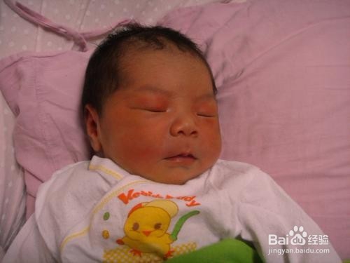 婴儿溢奶的原因分析