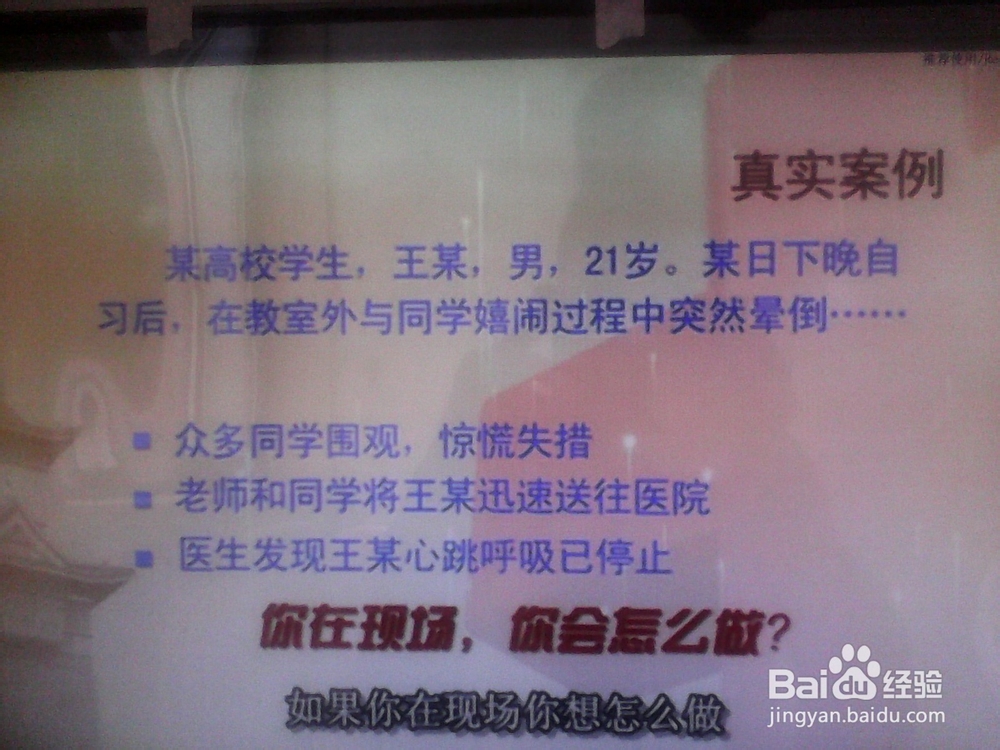 心脏骤停的现场急救