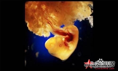 母亲怀孕时婴儿长什么样