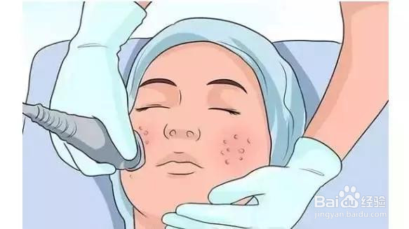 怎样控制皮肤长黑头