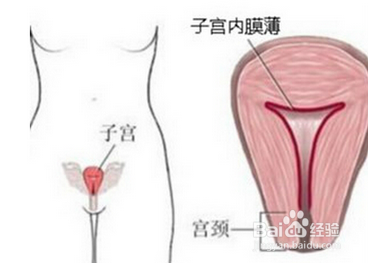 引发子宫腺肌症的原因