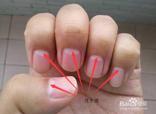 怎么看手指甲判断身体健康？
