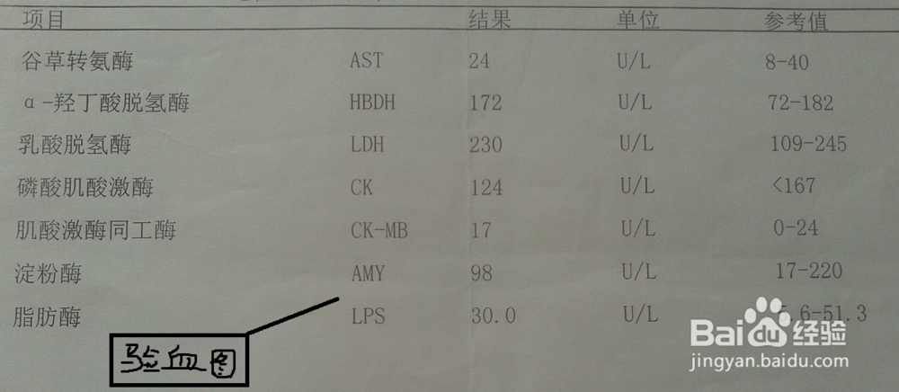 疑患腮腺炎怎么办