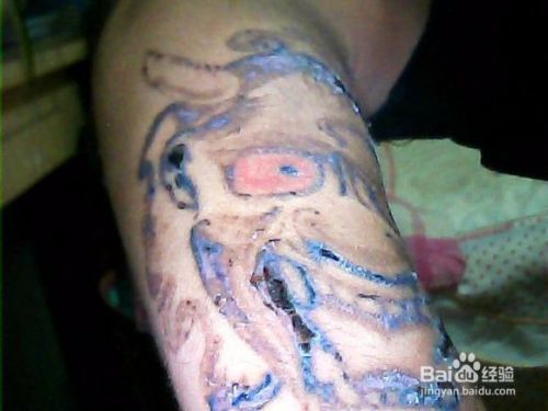 如何清洗去掉身上的纹身 百度经验