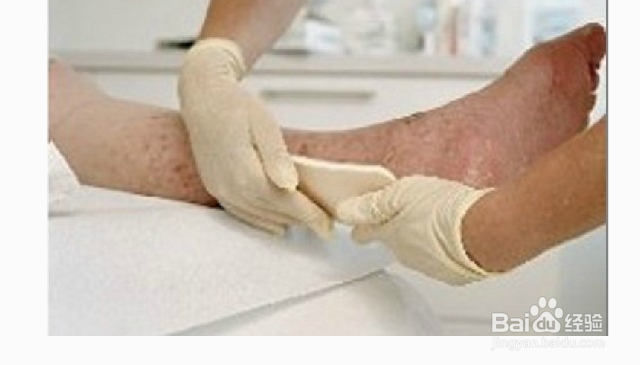 泡沫敷贴的使用方法