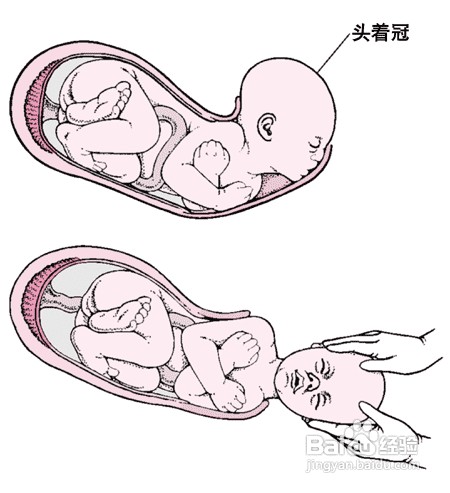 产妇如何预防宫缩乏力