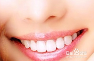 烤瓷牙为什么会出现黑线，出黑线怎么处理？