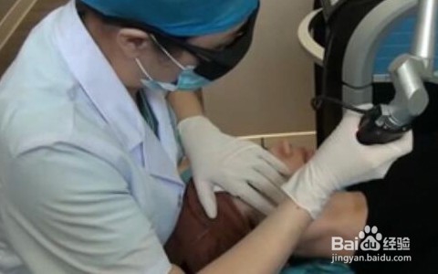 激光真的能祛斑吗_皮秒去雀斑有副作用吗