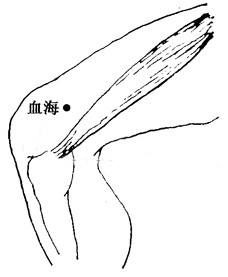 百病刮痧：[43]湿疮的刮痧疗法