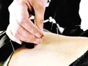 针灸减肥的方法与技巧