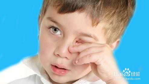 洗衣液进眼睛了怎么办