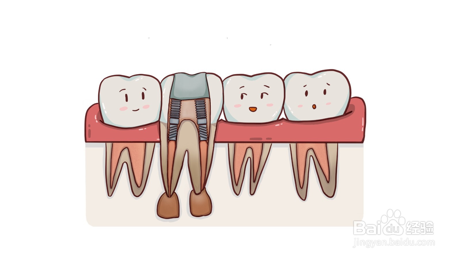 什么是根管治疗？有什么危害？