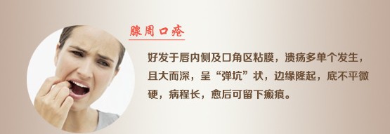 口腔溃疡膜的使用方法