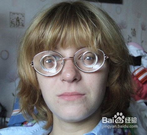 眼睛干涉是怎么回事?如何预防?